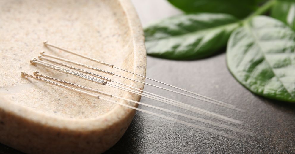 Several acupuncture needles rest on a stone plate