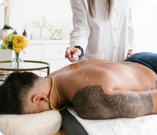Person receiving acupuncture, a core TCM therapy, from a practitioner in a clinical setting.