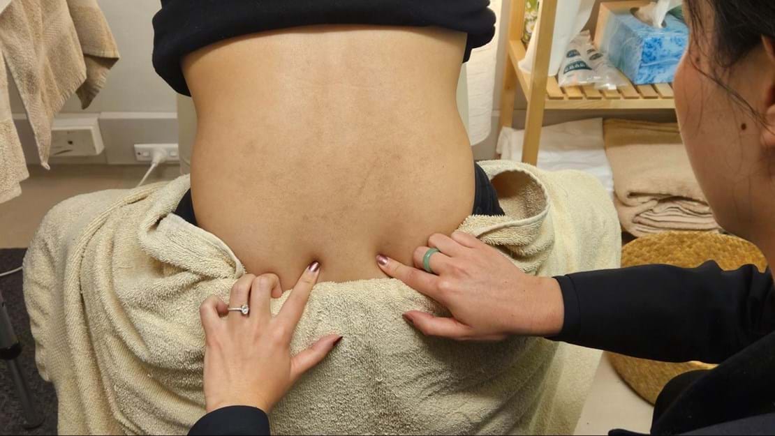 Person receiving a lower back massage with towel, inspired by TCM healing practices.
