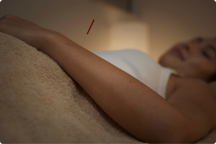 A person lies on a table with an acupuncture needle inserted, a practice rooted in TCM.