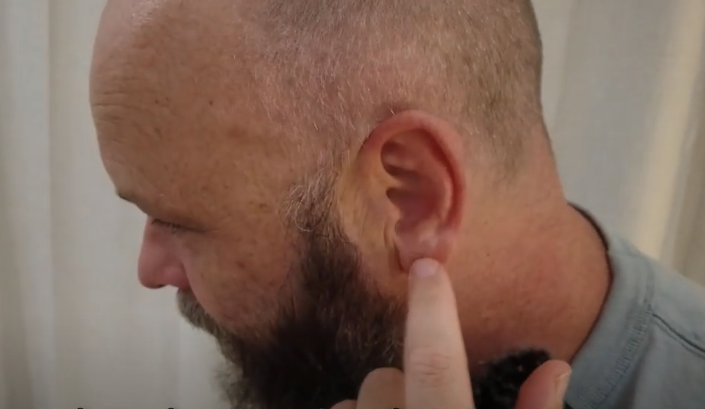Man with a beard points to his left ear, suggesting tcm therapy; white curtain in background.
