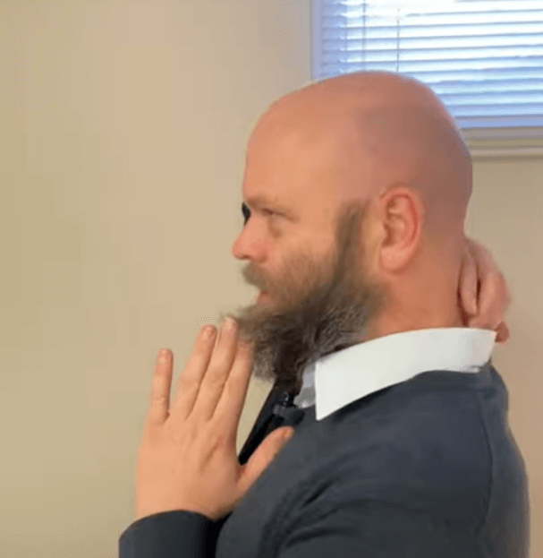 Bald man in profile with hand on neck, possibly seeking relief through TCM or acupuncture.