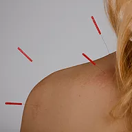 Shoulder Bursitis Treatment at Village Remedies